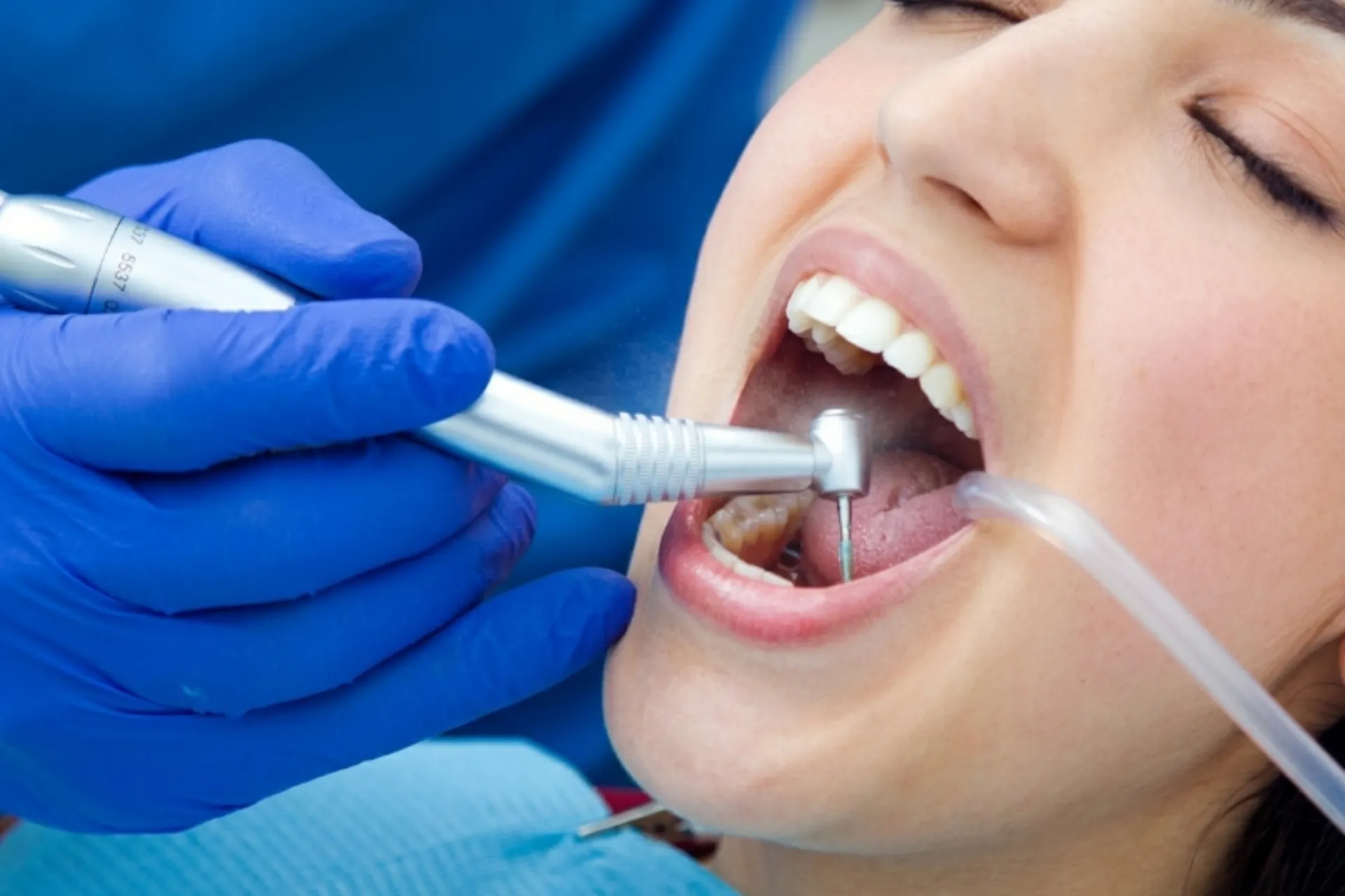 Deep Cleaning Dental