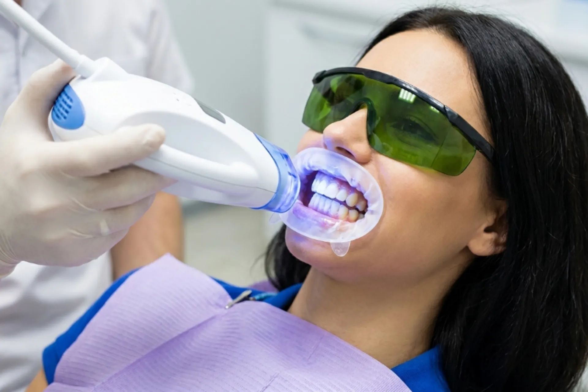 Teeth Whitening